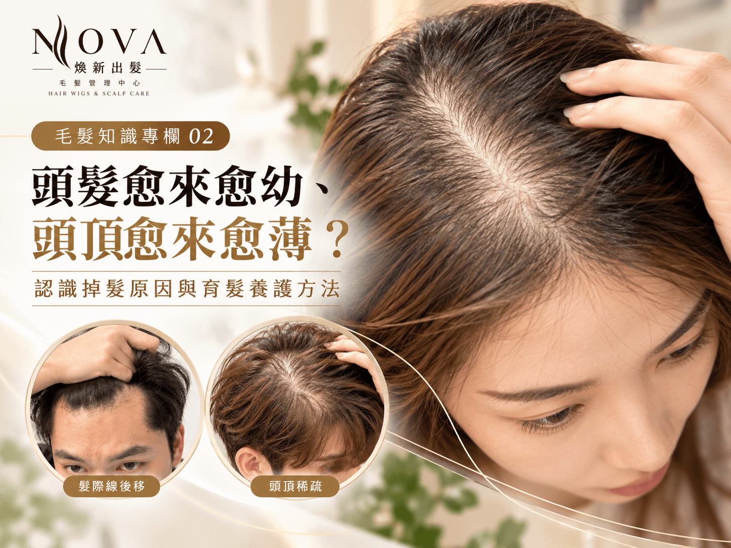 NOVA 煥新出髮毛髮知識專欄封面,展示女士頭頂分界線變闊、髮絲變幼及頭髮稀疏情況,配合男士髮際線後移及頭頂稀疏特寫,介紹常見掉髮原因與育髮養護方法。